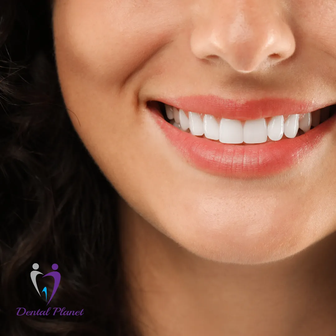 Best Dentist in Mysore